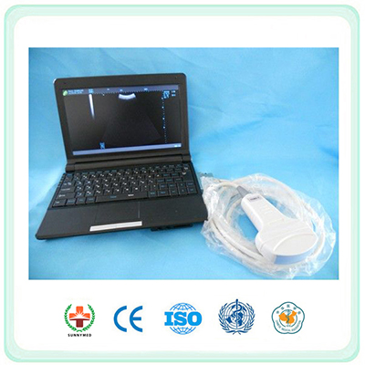 SLP01 Laptop Ultrasound Scanner